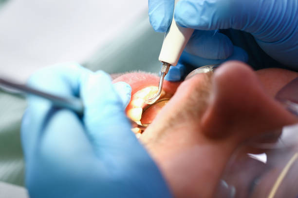 Best Emergency Dental Care for Broken or Chipped Teeth in Blennerhassett, WV