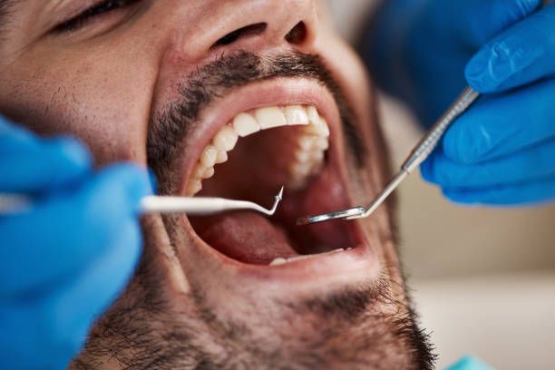 Best Emergency Wisdom Teeth Removal in Blennerhassett, WV