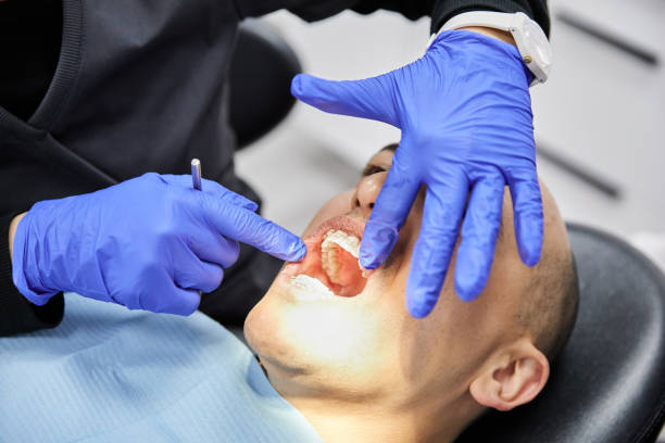 Best Emergency Tooth Extraction in Blennerhassett, WV